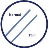 Standard design
